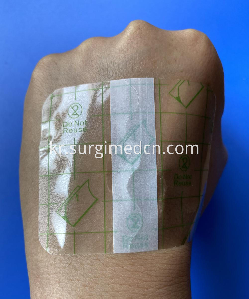 Waterproof Wound Dressing 11